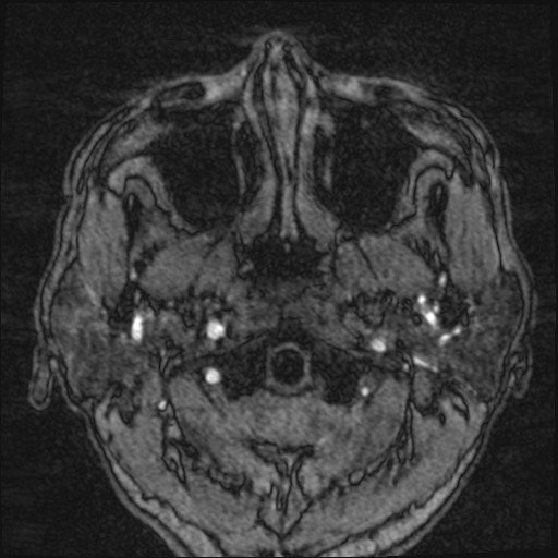 Click on the Serie image to view the images of VILLANUEVA, WILLIAM A.